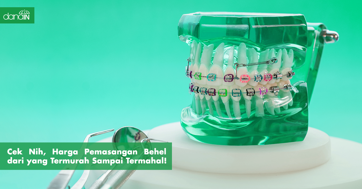 Cek Nih Harga Pemasangan Behel Dari Yang Termurah Sampai Termahal Blog